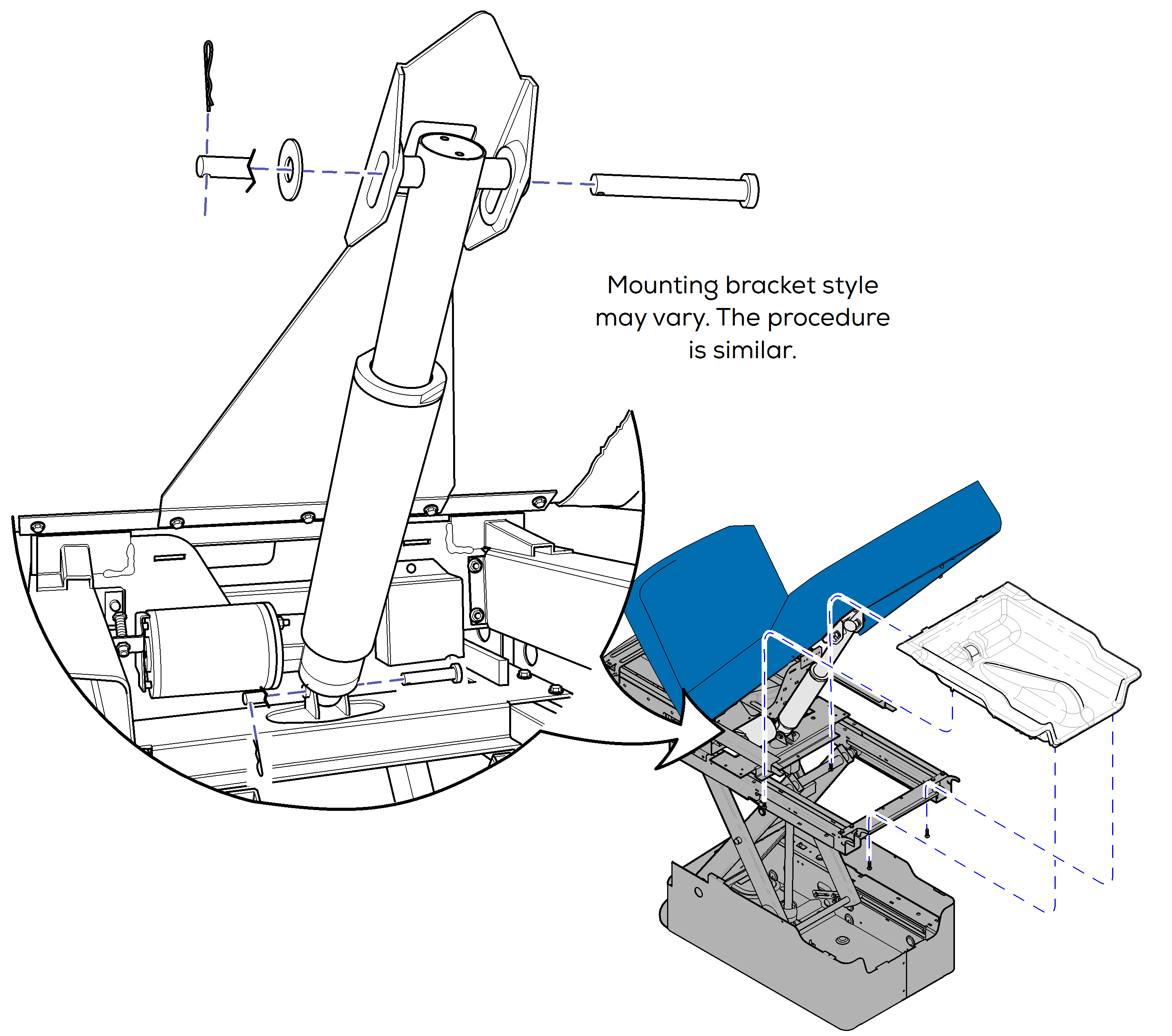 Back Actuator 