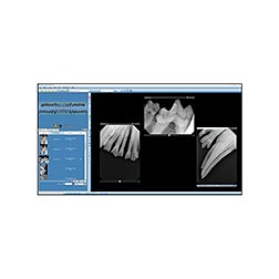 Midmark Imaging Software (Vet)