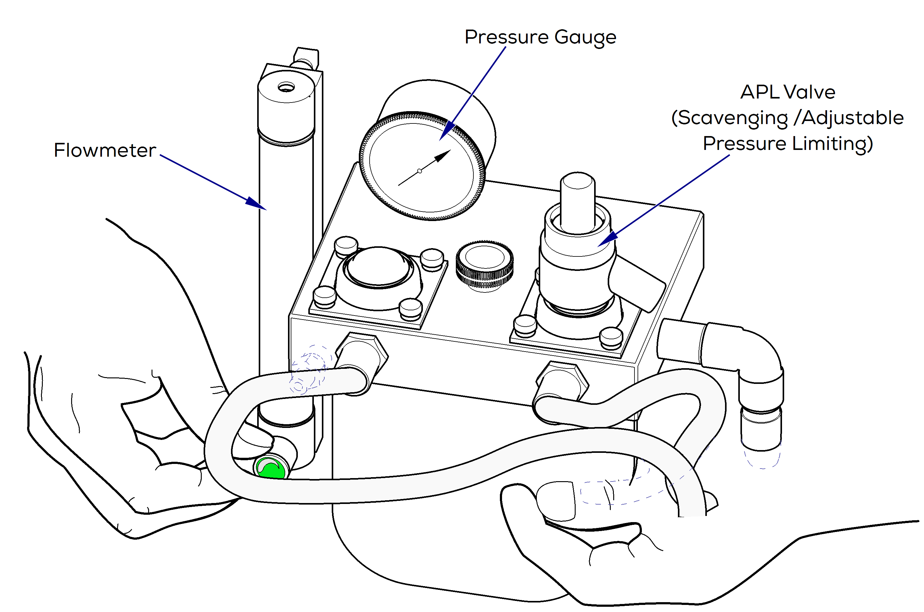 Anesthesia Leak Test for Models VME and VME2